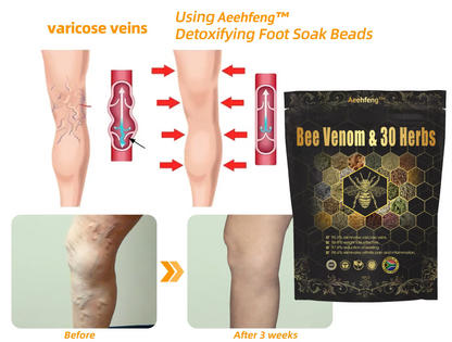 Last day to get 70% OFF: Aeehfeng™ Bee Venom & 30-Herb Detox Foot Soak Beads for Body Sculpting-South African Lymphoedema Association (SALA) Recommendation🐝🐝