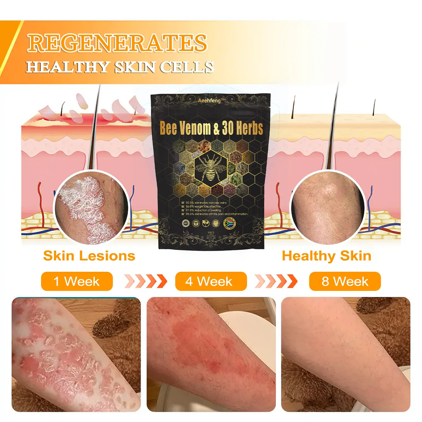 Last day to get 70% OFF: Aeehfeng™ Bee Venom & 30-Herb Detox Foot Soak Beads for Body Sculpting-South African Lymphoedema Association (SALA) Recommendation🐝🐝