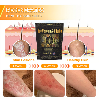 Last day to get 70% OFF: Aeehfeng™ Bee Venom & 30-Herb Detox Foot Soak Beads for Body Sculpting- Recommended by the America Lymphatic Academy (ALA)