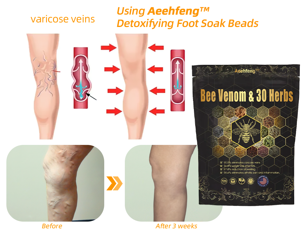 Last day to get 70% OFF: Aeehfeng™ Bee Venom & 30-Herb Detox Foot Soak Beads for Body Sculpting- Recommended by the America Lymphatic Academy (ALA)